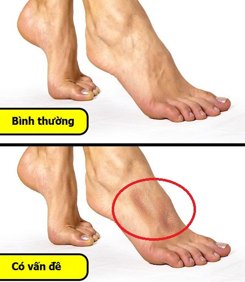 Picture 7 of Very simple health test tips