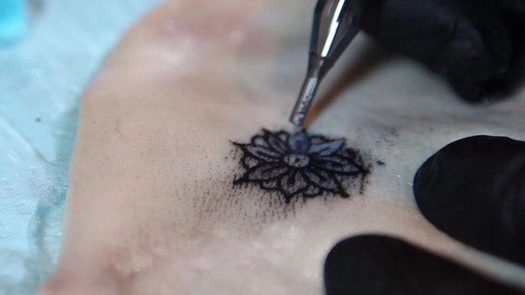 Picture 1 of Video: Body reaction makes tattoo permanent