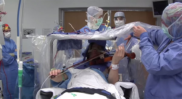 Picture 1 of Video: Brain surgery while playing violin