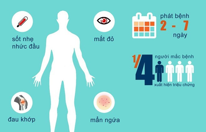 Picture 2 of Vietnam discovered the first 2 cases of Zika virus