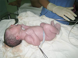 Picture 2 of Vietnam: Preparing stem cell transplantation to regenerate skin tissue