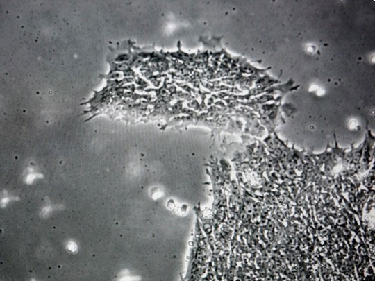 Picture 1 of Virus detection makes people silly