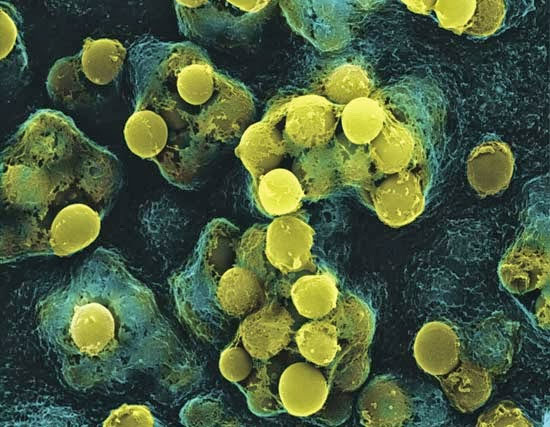 Picture 1 of Virus infected 10 people, dead 9 easy to spread on air?
