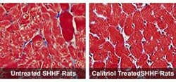 Picture 1 of Vitamin D: A new way to treat heart failure?