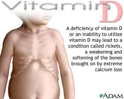 Picture 3 of Vitamin D reduces the aging process