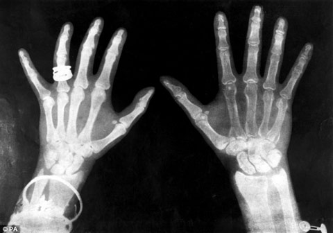 Picture 8 of Vote the greatest scientific invention in history