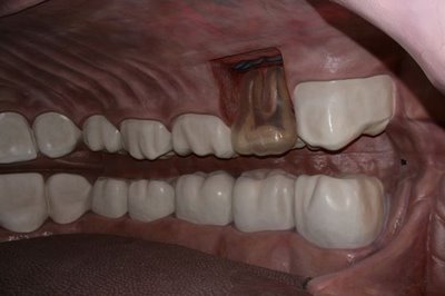 Picture 6 of Walking in the human body
