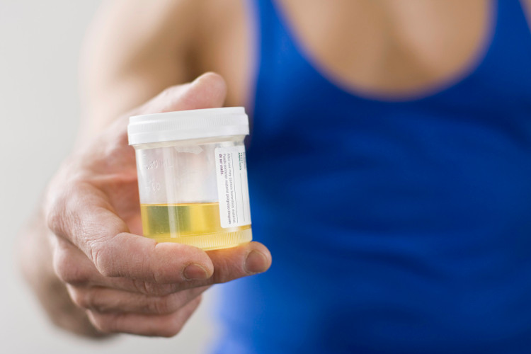 Picture 2 of Warning about health status from urine