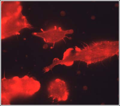 Picture 2 of Warning for listeria infection