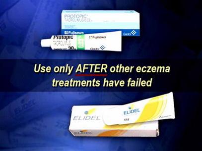 Picture 1 of Warning of cancer risk when using Elidel and Protopic