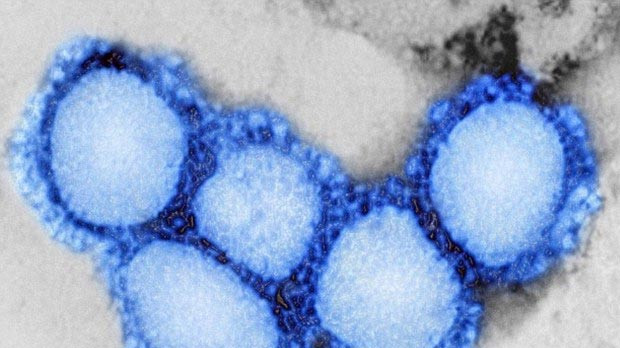Picture 1 of Warning of the risk of outbreaks from new SARS-like viruses
