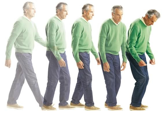 Picture 2 of Warning signs of Parkinson's disease