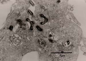 Picture 2 of Watch out for dog-borne diseases