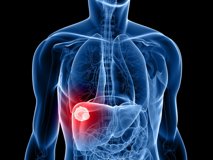 Picture 2 of Watch out for signs of liver cancer like artist Bao Quoc