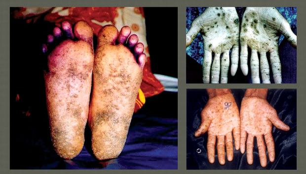 Picture 1 of We may be living with the poison 68 times more than arsenic in the kitchen without even knowing it