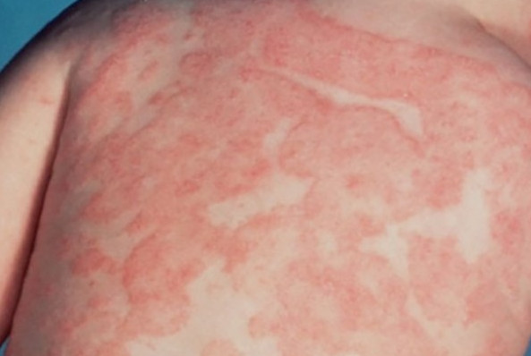 Picture 5 of What are the dangers of fabric dyeing water?