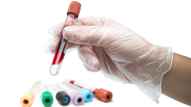 Picture 1 of What blood tests can you know about?