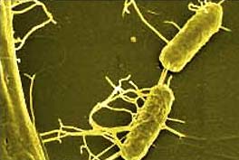 Picture 2 of What do you understand about infections?