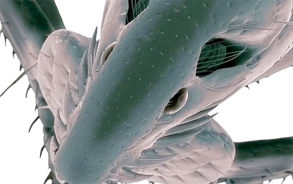 Picture 1 of What happens if all the parasites on Earth disappear?