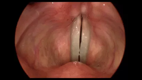 What happens in the throat of a person while beatboxing? images 1