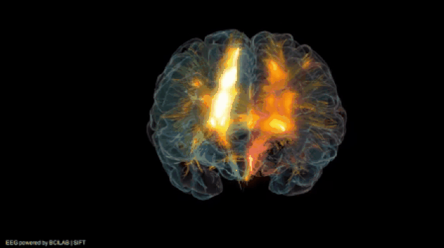 Picture 5 of What happens to the body when you drink a coffee?