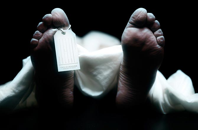 Picture 1 of What happens when you donate your body to science after your death?