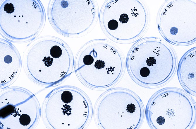 Picture 6 of What happens when you donate your body to science after your death?