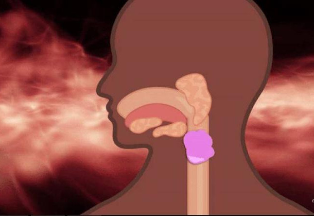 Picture 1 of What happens when you swallow gum