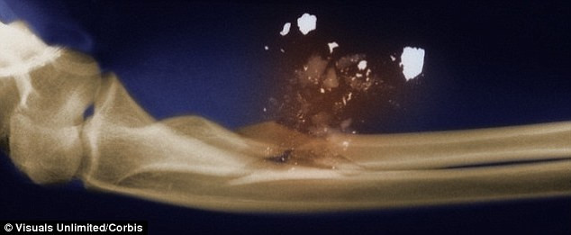 Picture 4 of What horrible thing will happen when a body is hit by a bullet?
