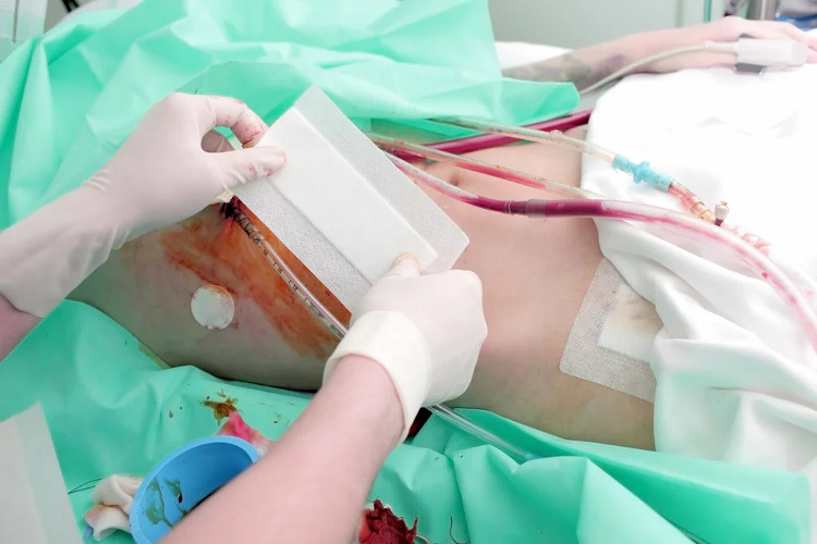 Picture 2 of What if people live with only one kidney until the end of their lives?