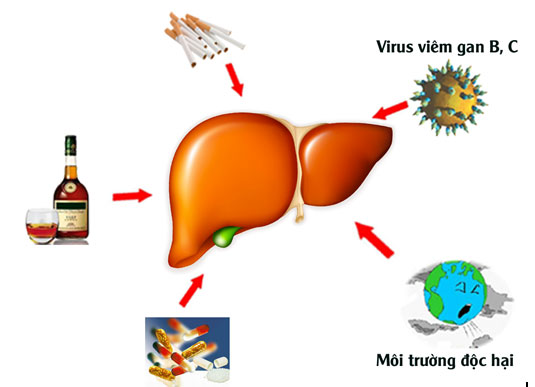 Picture 2 of What is cirrhosis?  Who is most likely to develop cirrhosis?