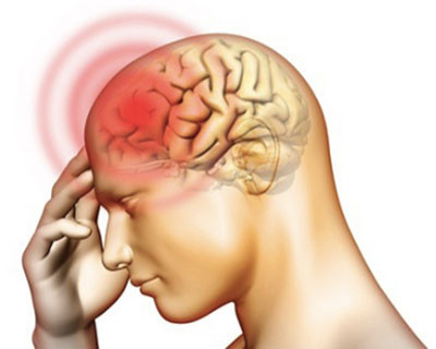 Picture 2 of What is meningeal syndrome?