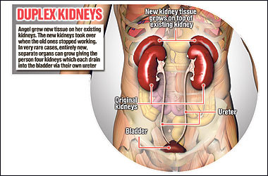 Picture 2 of What is organ transplantation?