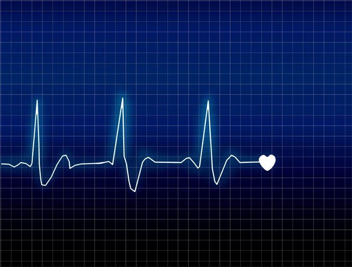 Picture 2 of What is the normal heart rate?