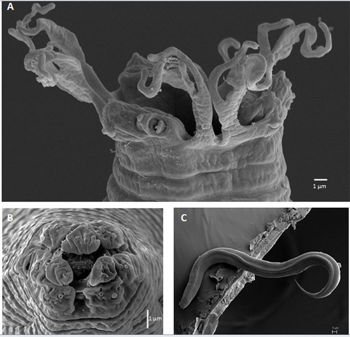 What is the role of nematode in the Vietnamese female doctor who spent a decade decoding? images 2