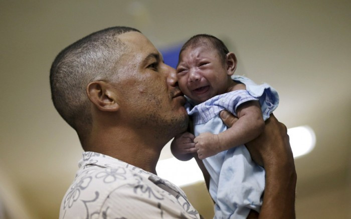 Picture 1 of What is the small head disease caused by Zika mosquito virus?