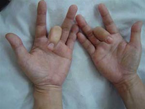 Picture 1 of What is 'turn on finger'?
