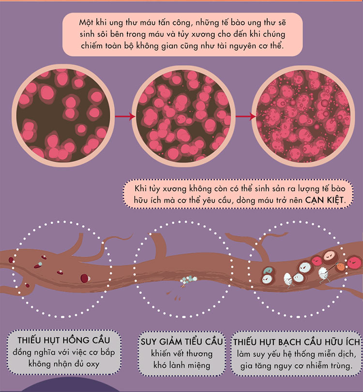Picture 7 of What is white blood disease?