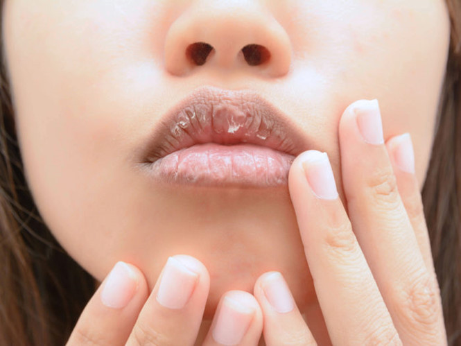 Picture 1 of What lips reveal something about your health?