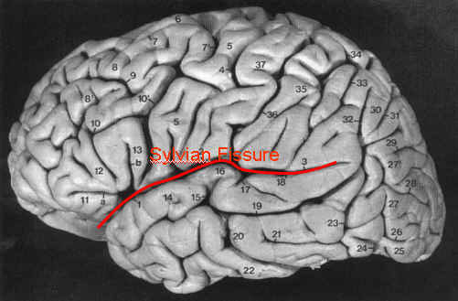 Picture 8 of What scientists did with Albert Einstein's brain