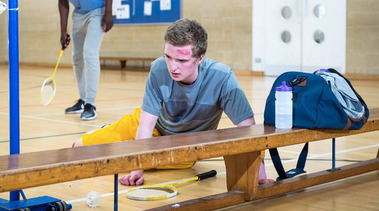 Picture 2 of What should you do when you hit your head hard?
