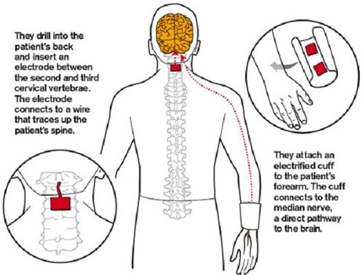 Picture 7 of What will happen if the electric click on the brain dies?
