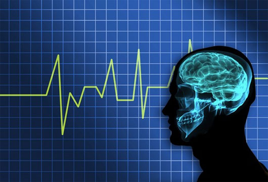 Picture 8 of What will happen if the electric click on the brain dies?