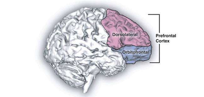 Picture 3 of When hypnotized, what happens to your brain?