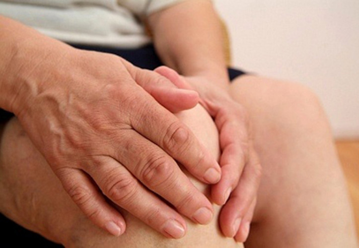 Picture 3 of Where does gout come from?
