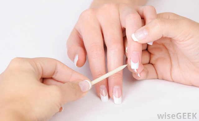 Picture 3 of Where does the stain of color written under the nail come from?
