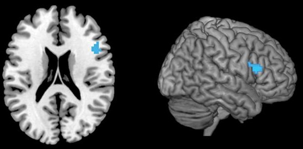 Picture 3 of Where does your voice come from?