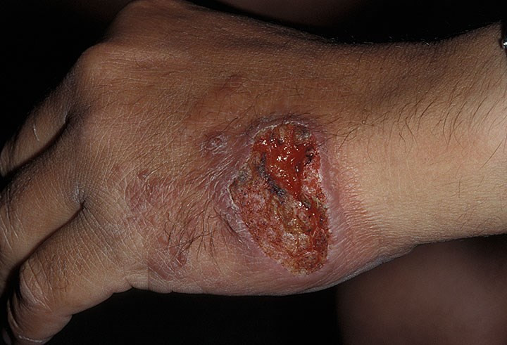 Picture 2 of WHO put recommendations on what to do to prevent the spread of resistant bacteria