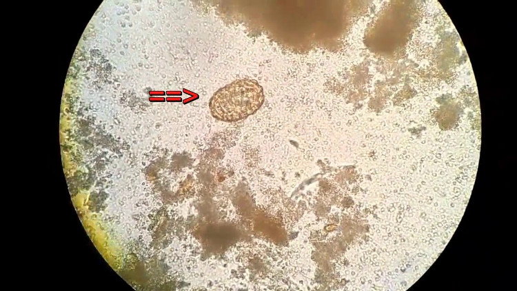 Picture 4 of Why are intestinal parasites not digested in our bodies?