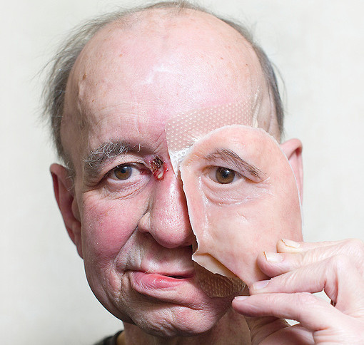 Picture 1 of Why are more men dying of cancer than women?